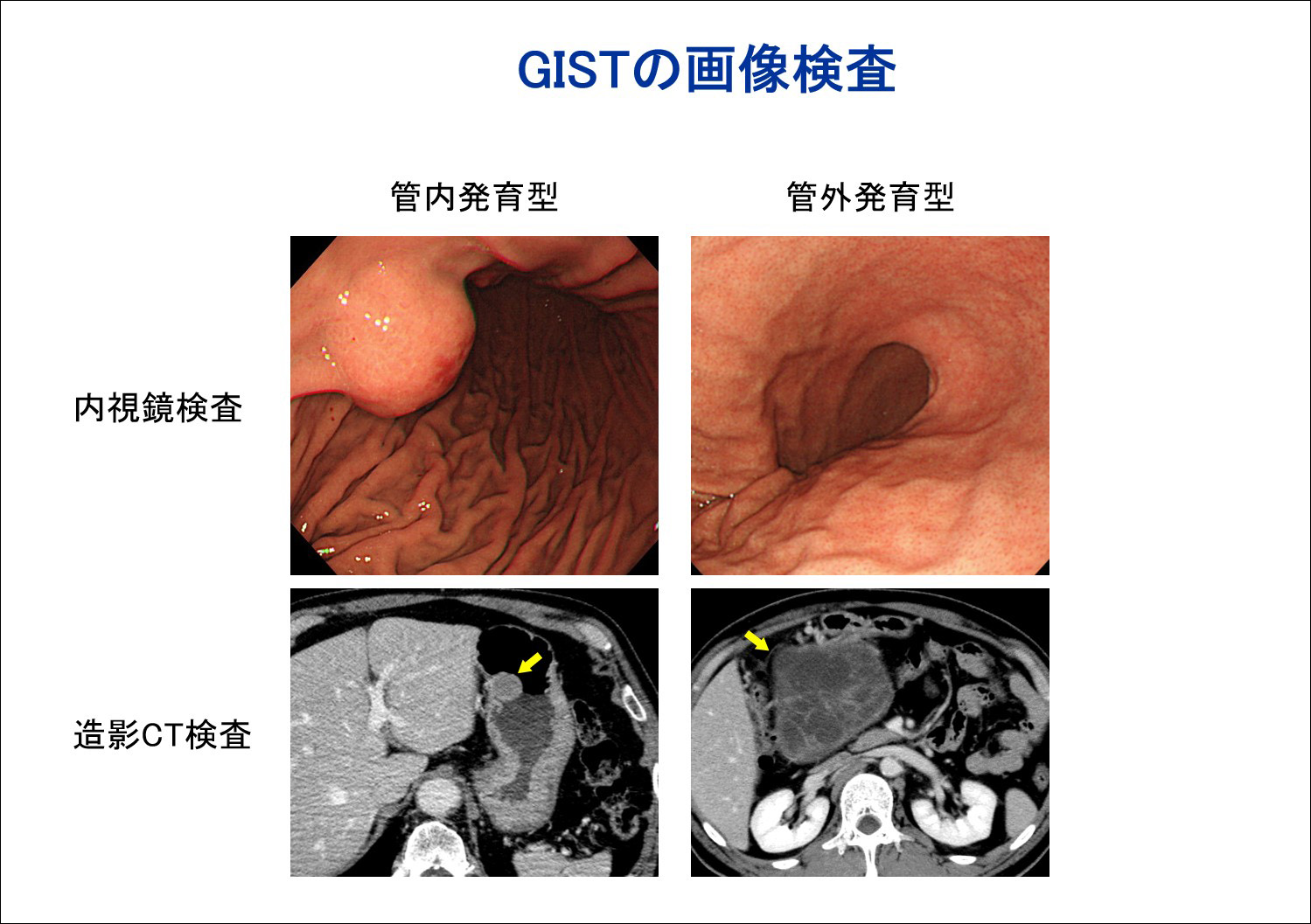 すべての良性皮膚腫瘍をスクリーニングして切除する必要がありますか?
