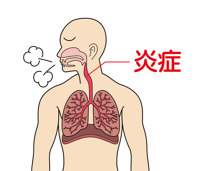 呼吸がゼーゼーする